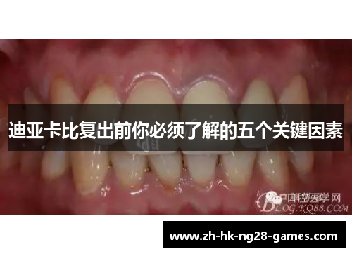 迪亚卡比复出前你必须了解的五个关键因素